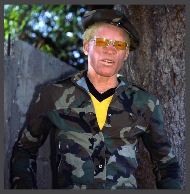 Yellowman photo 1