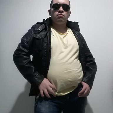 D. Limma